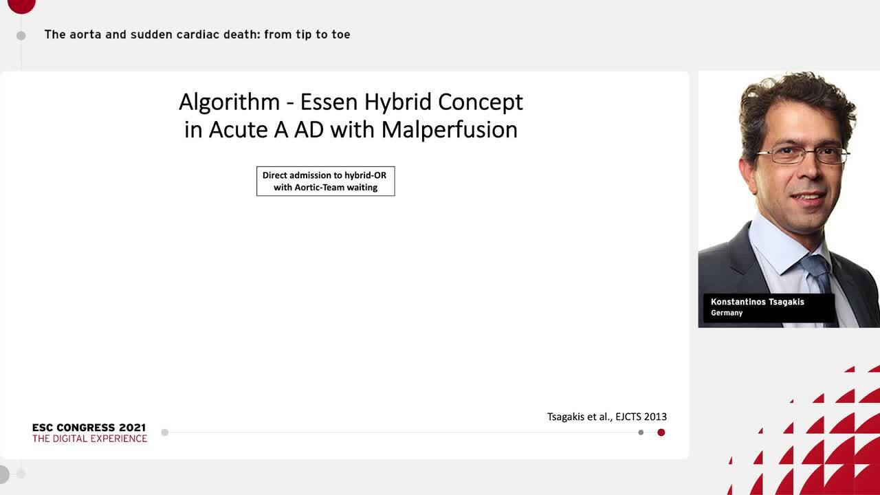 Acute aortic syndromes: critical pathways from the emergency room to the operating room.
