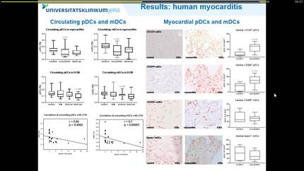 Characterization of plasmacytoid and myeloid dendritic cells in acute human and experimental myocarditis
