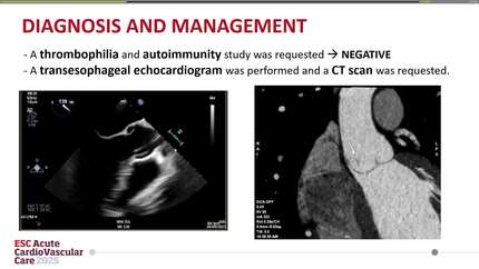 Presentation thumbnail