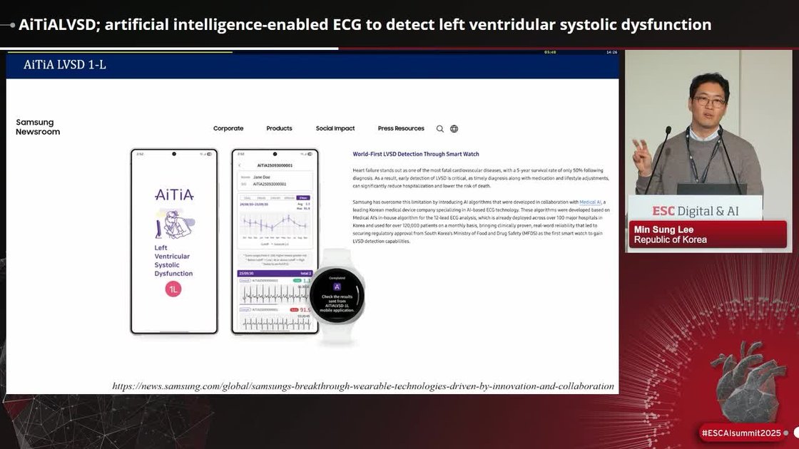 ESC 365 - AiTiALVSD; artificial intelligence-enabled ECG to detect left ...