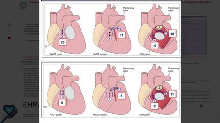 Presentation thumbnail