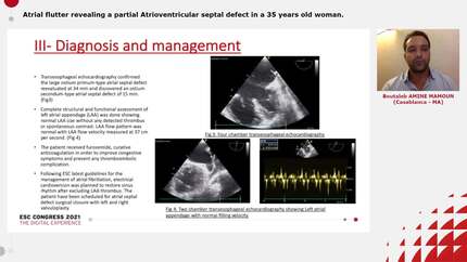 Presentation thumbnail