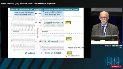 What the experts do when the first ventricular tachycardia (VT) ablation fails
