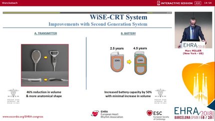 Left ventricular leadless pacing
