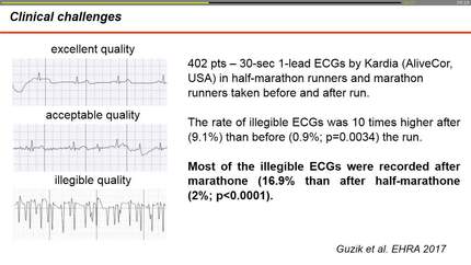 Mobile phone ECG applications and wearables.