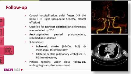 Presentation thumbnail