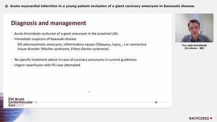 Acute myocardial infarction in a young patient occlusion of a giant coronary aneurysm in Kawasaki disease.