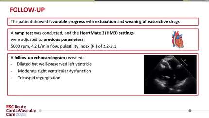 Refractory hypoxia due to patent foramen ovale (PFO) during ablation of pericannular ventricular tachycardia in the context of arrhythmic storm in a patient with left ventricular assist device (LVAD)