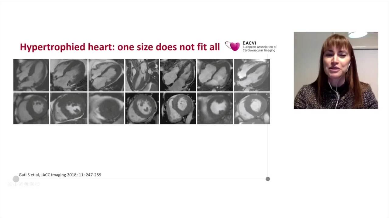 The hypertrophied heart: how to get the best out of each imaging modality