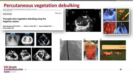 Presentation thumbnail
