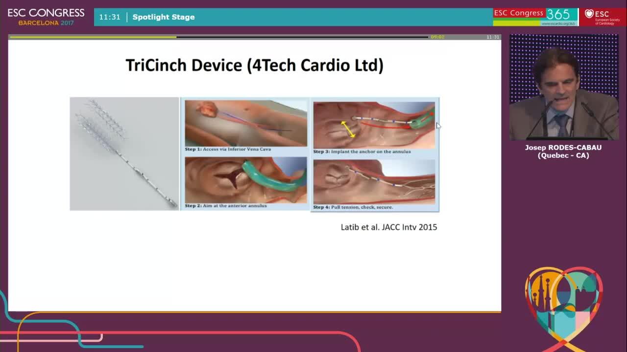 What to do with tricuspid regurgitation after MV repair