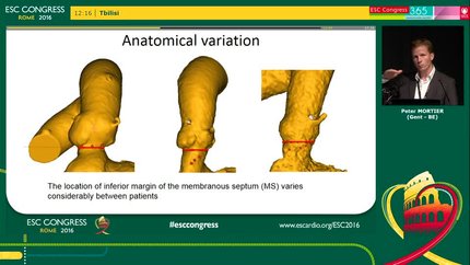 Presentation thumbnail
