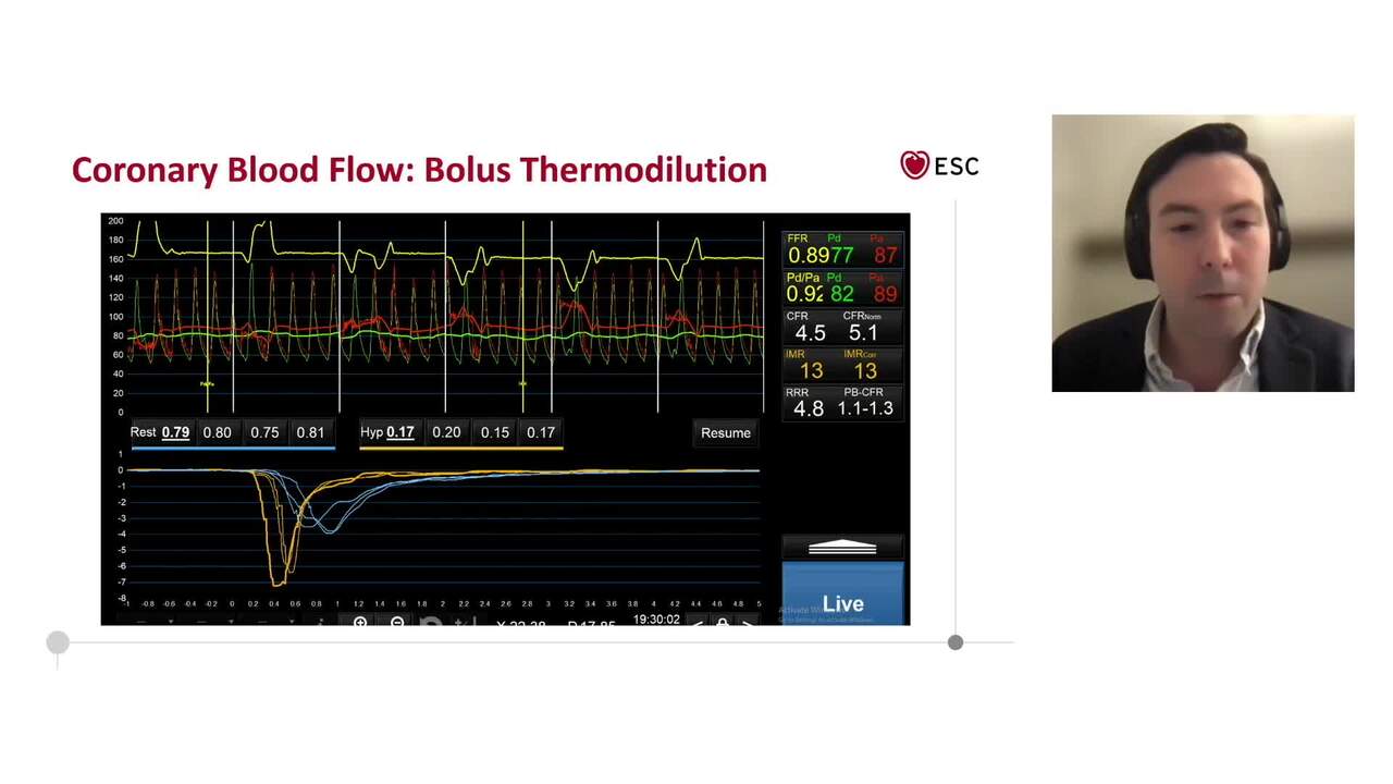 Angina/ischaemia with non-obstructive coronary arteries (ANOCA/INOCA)