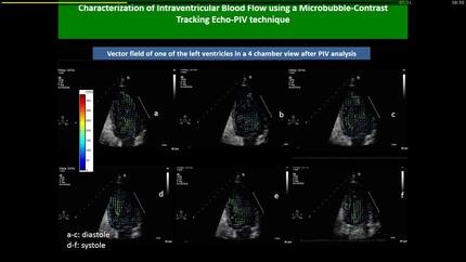 A quantitative and qualitative characterization of the intraventricular blood flow of the normal human left ventricle using a contrast-tracking echo-PIV technique
