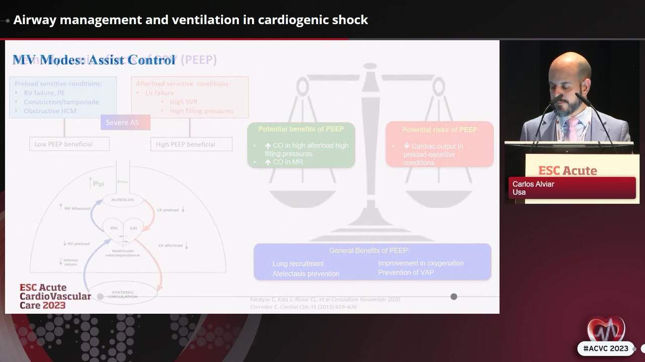 Cardiogenic shock in real life; how to handle the difficulties