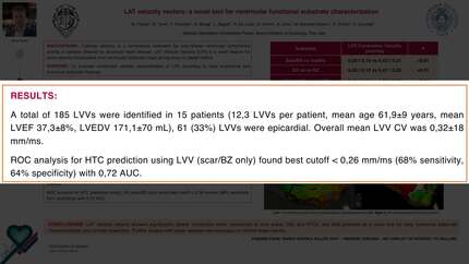 LAT velocity vectors: a novel tool for ventricular functional substrate characterization.