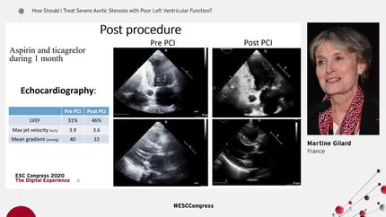 Presentation thumbnail