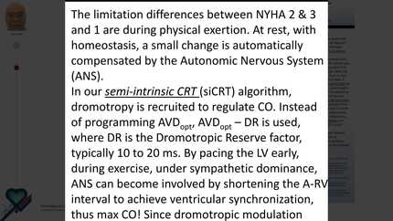 Autonomic nervous system driven resynchronization therapy using left ventricular only pacing with electrocardiographic optimization. A new paradigm. 9+ month follow-up of dual chamber systems.