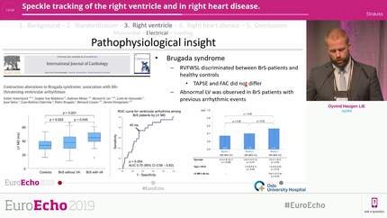 Speckle tracking of the right ventricle and in right heart disease.