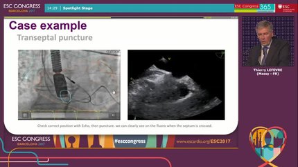 Presentation thumbnail