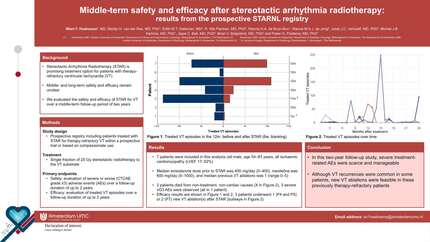 Middle-term safety and efficacy after stereotactic arrhythmia radiotherapy: results from the prospective STARNL registry