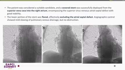 Presentation thumbnail