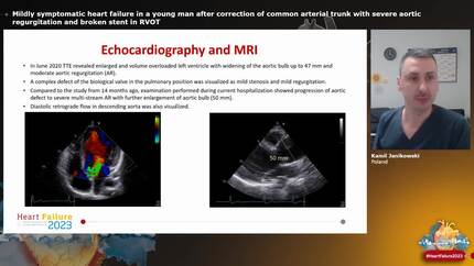 Mildly symptomatic heart failure in a young man after correction of common arterial trunk with severe aortic regurgitation and broken stent in RVOT
