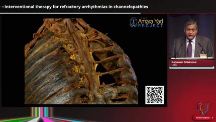 Risk stratification and advanced therapies in channelopathies