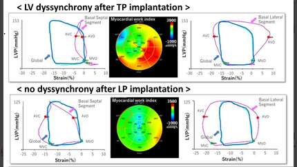 Presentation thumbnail