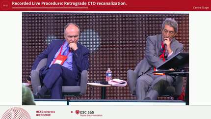 Recorded Live Procedure: Retrograde CTO recanalization.
