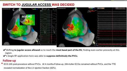 Presentation thumbnail