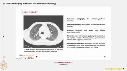 The challenging pursuit of Cor Pulmonale etiology.
