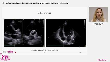 Difficult decisions in pregnant patient with congenital heart diseases.