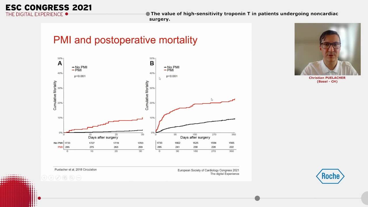 The value of high-sensitivity troponin T in patients undergoing noncardiac surgery.