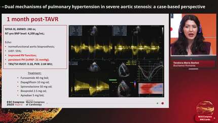Dual mechanisms of pulmonary hypertension in severe aortic stenosis: a case-based perspective