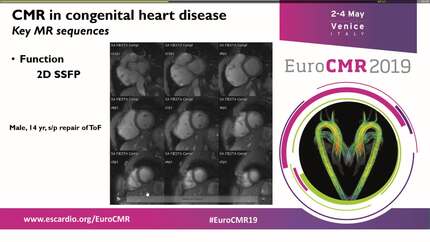 What an adult CMR clinician needs to know about congenital heart diseases.