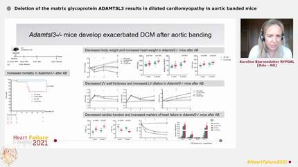 Deletion of the matrix glycoprotein ADAMTSL3 results in dilated cardiomyopathy in aortic banded mice
