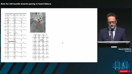 Role for left bundle branch pacing in heart failure.