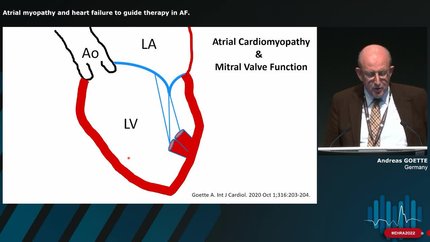 Atrial myopathy in atrial fibrillation (AF) patients