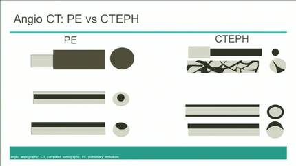 Presentation thumbnail