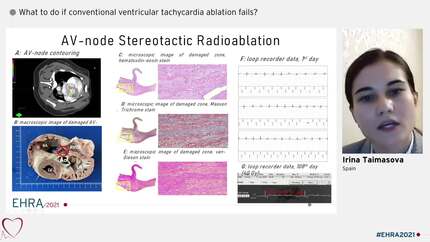 Experimental use of stereotactic radiosurgery for non-invasive interventions in arrhythmology