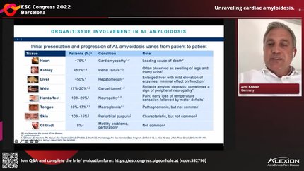 Unraveling cardiac amyloidosis.