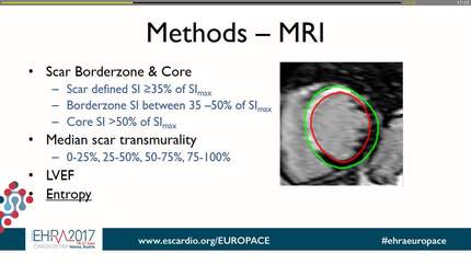 Scar composition and transmurality derived from LGE MRI predicts VT in post-infarct patients