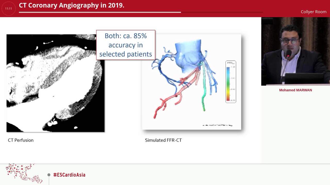 CT Coronary Angiography in 2019.