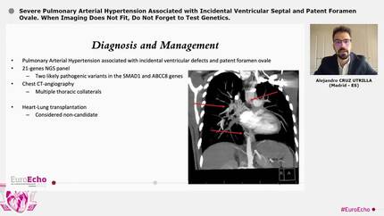 Severe Pulmonary Arterial Hypertension Associated with Incidental Ventricular Septal and Patent Foramen Ovale. When Imaging Does Not Fit, Do Not Forget to Test Genetics.