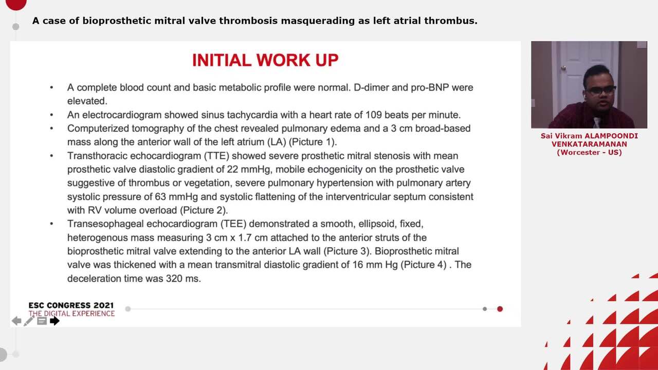 A case of bioprosthetic mitral valve thrombosis masquerading as left atrial thrombus.