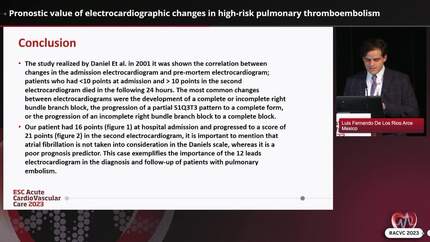 Pronostic value of electrocardiographic changes in high-risk pulmonary thromboembolism