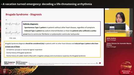 A vacation turned emergency: decoding a life-threatening arrhythmia