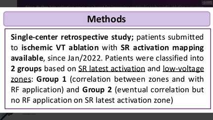 Sinus rhythm late activation zones as a target for improving ventricular tachycardia ablation outcomes