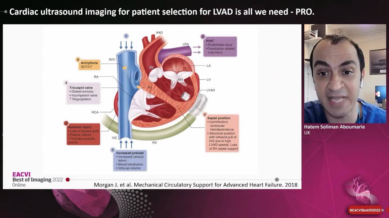 ESC 365 - Cardiac ultrasound imaging for patient selection for LVAD is ...